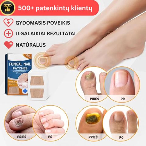 Ravivad plaastrid küüntele